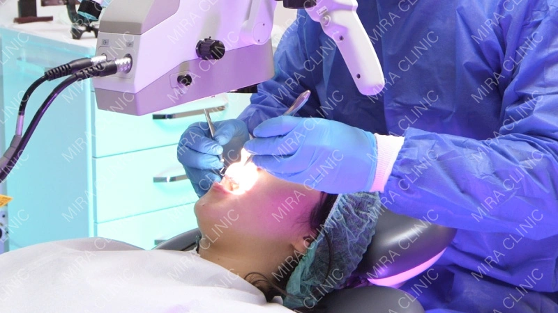 Tooth Preparation